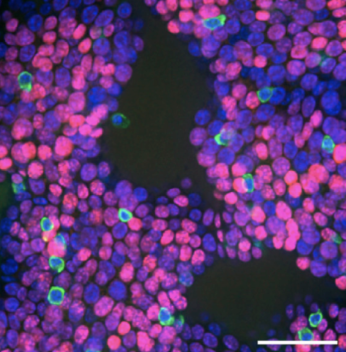 Oral epithelial cell analysis