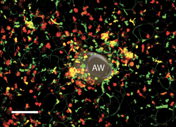 Monocyte differentiation tracking